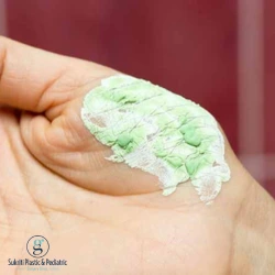 Why Applying Toothpaste on Burns Is Dangerous plastic surgeon in Indore, Dr. Geetika Paliwal Indore, burn treatment in Indore, plastic burn specialist in Indore, burn first aid, burn care clinic in Indore, burn doctor in Indore, toothpaste on burns treatment Indore, plastic emergency care Indore, minor burn treatment for kids Indore, scald burn treatment in Indore, burn injury treatment in Indore, plastic surgery clinic Indore, skin burn care Indore, burn wound care for kids Indore, hot water burn treatment Indore, kitchen burn treatment for children Indore, electrical burn care in Indore, chemical burn treatment, burn blister treatment in Indore, plastic burn consultation Indore, emergency plastic surgeon Indore, best plastic surgeon in Indore, burn first aid Indore, plastic scald injury treatment Indore, burn prevention tips for parents Indore, burn specialist near me Indore, plastic burn care near me Indore, plastic surgeon for burns in Indore, burn treatment doctor in Indore