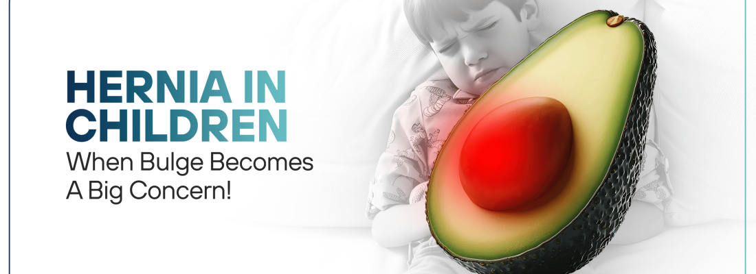 Hernia In Children When That Little Bulge Becomes A Big Concern